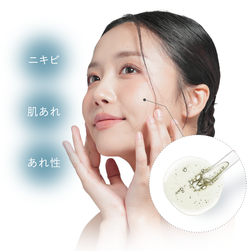 ニキビ・肌荒れを防ぐ※2グリチルレチン酸ステアリルの力揺らぎ知らずの健やかな肌へ